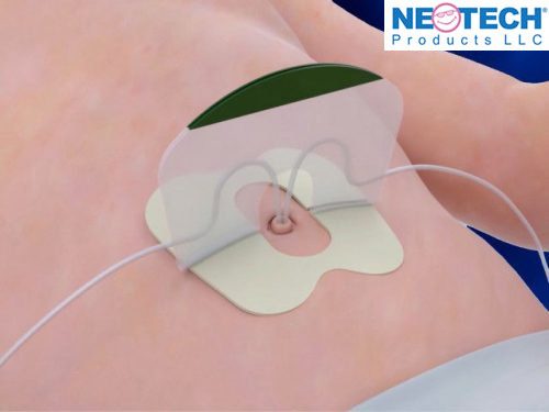 NeoBridge NeoBridge